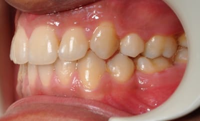 Dsc 0019 y57e2m - Eugenol