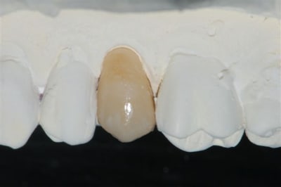 Dsc 0022 ouue4v - Eugenol