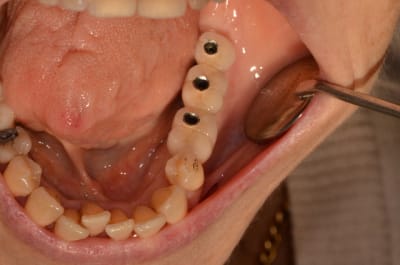 Dsc 0032 befcum - Eugenol