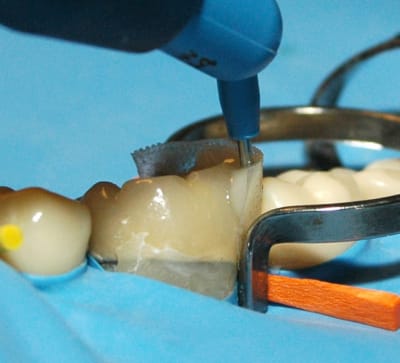 Dsc 0042charge jxretp - Eugenol