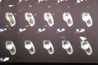 Dsc 0045 bjxolt - Eugenol