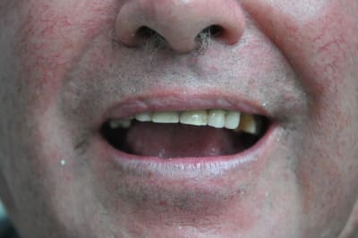 Dsc 0053 om00gh - Eugenol