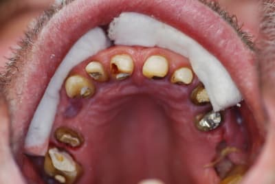 Dsc 0054 2 g33x66 - Eugenol