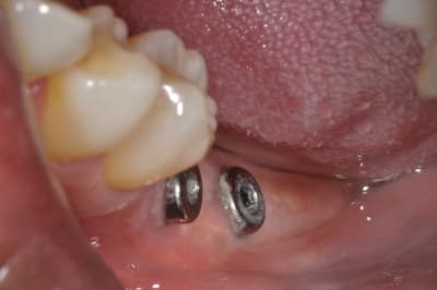 Dsc 0059 s2zn2l - Eugenol