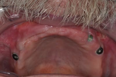 Dsc 0064 u3pqui - Eugenol