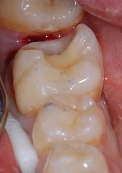 Dsc 0087 bkyhe2 - Eugenol