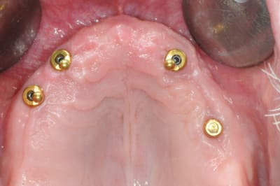 Dsc 0091 kn5smt - Eugenol