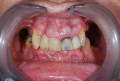 Dsc 0110 dpdf0a - Eugenol