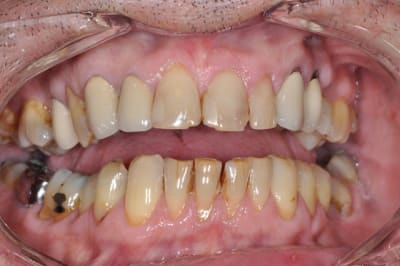 Dsc 0122 jn7rdh - Eugenol