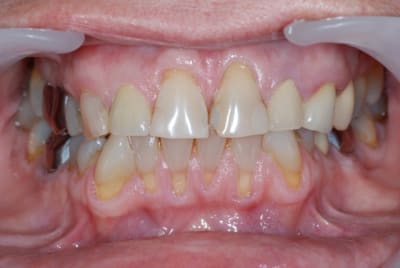 Dsc 0146 f7etkj - Eugenol