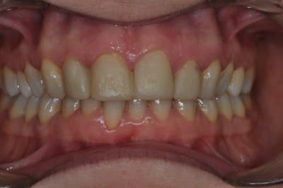 Dsc 0159 npnww2 - Eugenol