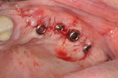 Dsc 0233 ym86vq - Eugenol