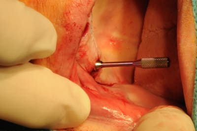 Dsc 0267 wg00cf - Eugenol