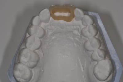 Dsc 0310 tnidts - Eugenol