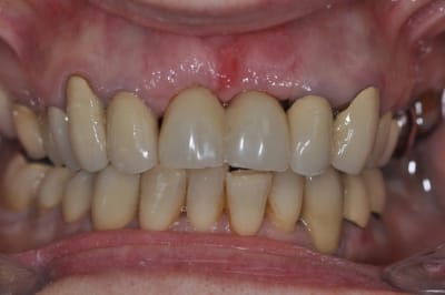 Dsc 0319 cim1xx - Eugenol