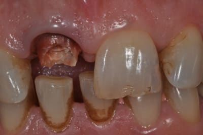 Dsc 0334 cgvc27 - Eugenol