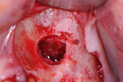 Dsc 0393 gi0nh0 - Eugenol