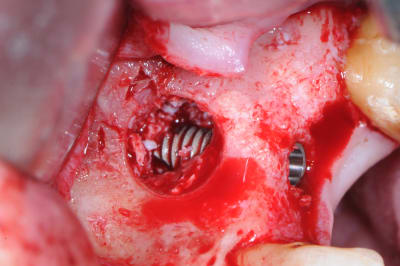 Dsc 0398 iwdclv - Eugenol