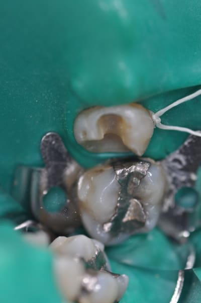 Dsc 0573 zrgp6l - Eugenol