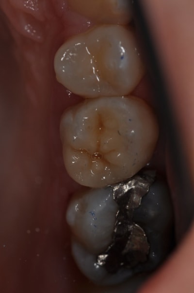 Dsc 0578 v7f6u3 - Eugenol