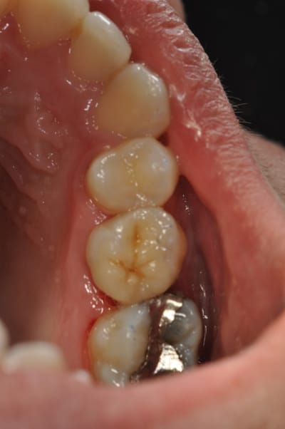 Dsc 0579 o9bve7 - Eugenol