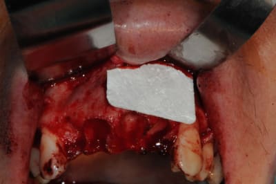 Dsc 0640 bobolt - Eugenol