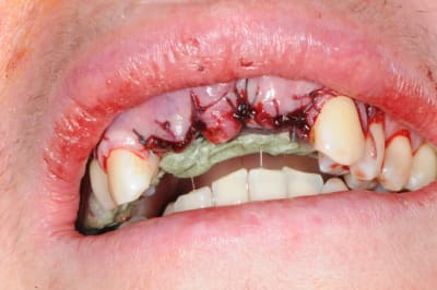 Dsc 0668 w20xze - Eugenol