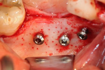 Dsc 1406 mxgg79 - Eugenol