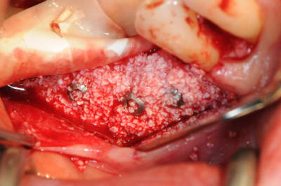 Dsc 1414 kiymbs - Eugenol