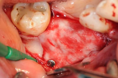 Dsc 1415 l4tqub - Eugenol