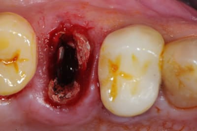 Dsc 1544 wuiujo - Eugenol