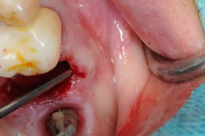 Dsc 1547 l7rsa3 - Eugenol