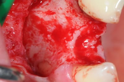 Dsc 1575 mbo2g5 - Eugenol