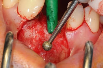 Dsc 1578 w1tzg2 - Eugenol