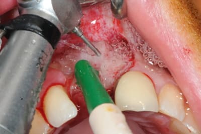 Dsc 1581 sl1hgk - Eugenol