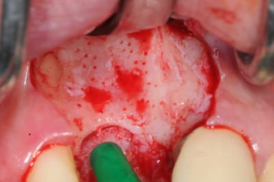 Dsc 1583 d48jrw - Eugenol