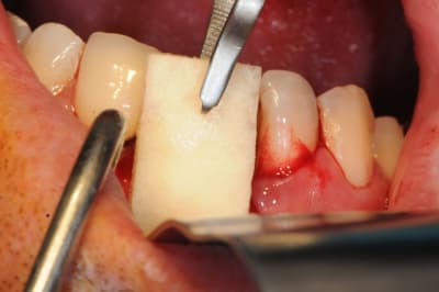 Dsc 1589 xl6zyu - Eugenol