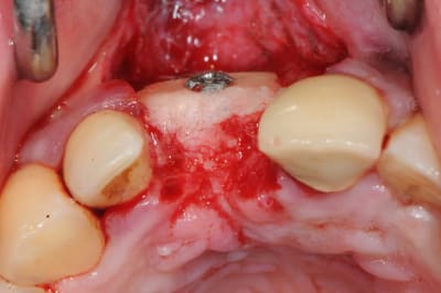 Dsc 1650 clt8hv - Eugenol