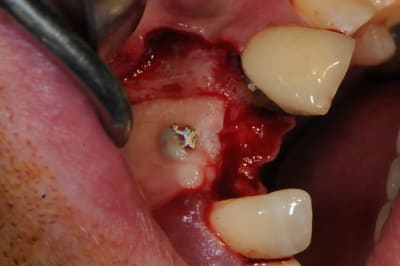 Dsc 1660 ccqys5 - Eugenol