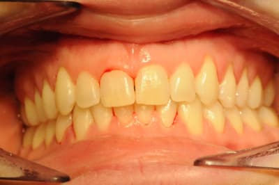 Dsc 1664 oeqqqy - Eugenol