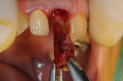 Dsc 1689 vt6zvh - Eugenol