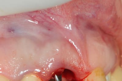 Dsc 1694 tyaqsz - Eugenol