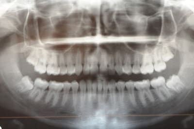 Dsc 1697 psnkg1 - Eugenol