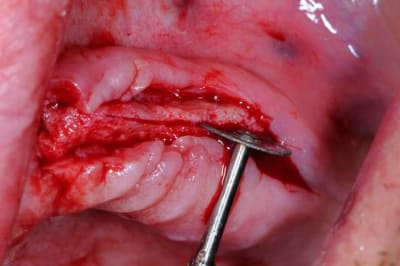 Dsc 1698 pumfne - Eugenol