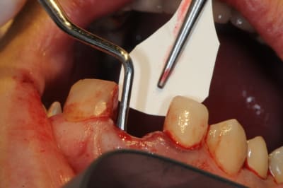 Dsc 1705 rz2zo9 - Eugenol