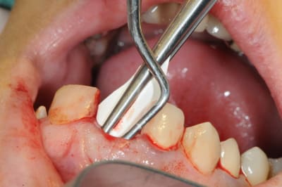 Dsc 1706 zv8zz4 - Eugenol