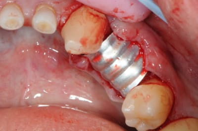 Dsc 2481 rury44 - Eugenol