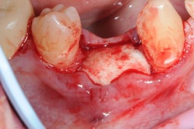 Dsc 2485 zdchj0 - Eugenol