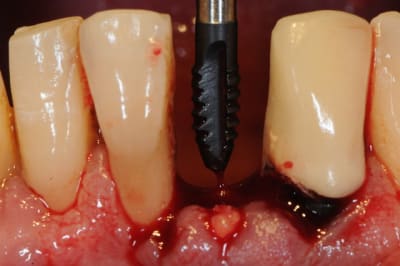 Dsc 2537 csp8wd - Eugenol