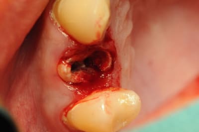 Dsc 2553 fer8mn - Eugenol